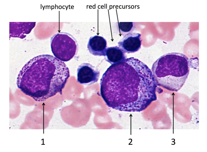 Image Source: https://www.pathologystudent.com/