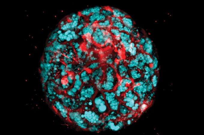 Organoid image