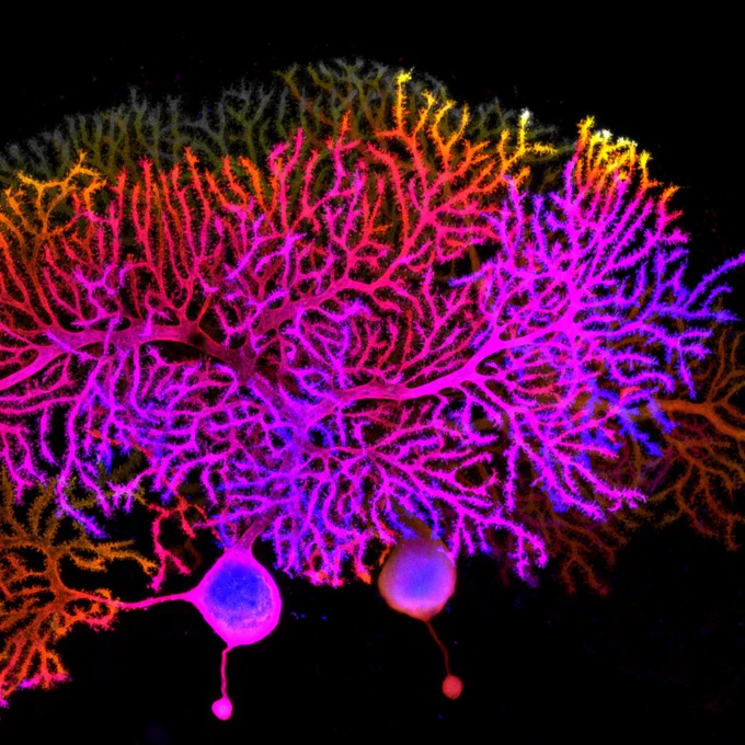 Title: Friend
Captation: Confocal stack colored with a depth scale (from blue, more superficial, to white, deeper). The huge dendritic trees full of spines are stacked one on top of the other in two almost parallel 2D planes.