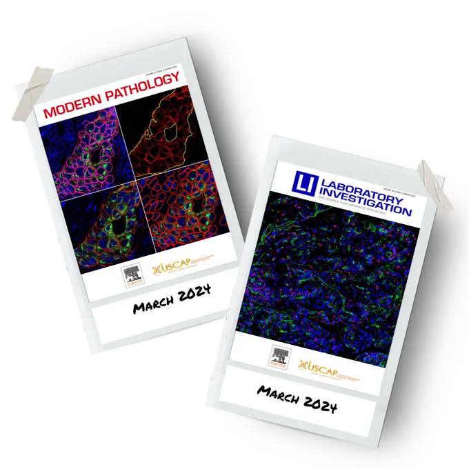 https://www.modernpathology.org/article/S0893-3952(24)00005-X/abstract