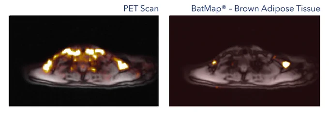 The glucose tracer in PET is taken up by more than brown adipose tissue. Inflamed tissues and skeletal muscle take glucose up too!