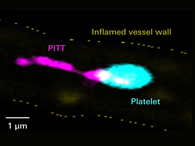 The PITTs - platelet-derived integrin- and tetraspanin-enriched tethers - observed here in the mouse by Bernhard Nieswandt are comet-tail-like organelles shed by platelets that interact with other cells in the vascular system modulate their function and thereby fuel inflammation and tissue damage.