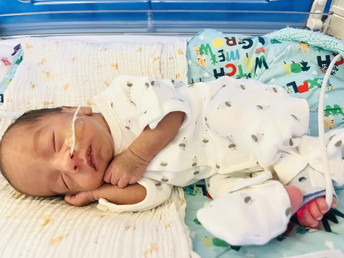 A baby is seen sleeping while wearing the new sleep suit. They are in a bed and have a small tube coming from their nose.