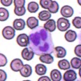 Image from rhesus macaque blood smear showing red blood cells and a Neutrophil with the shape of the nucleus making it look like a smiley face.