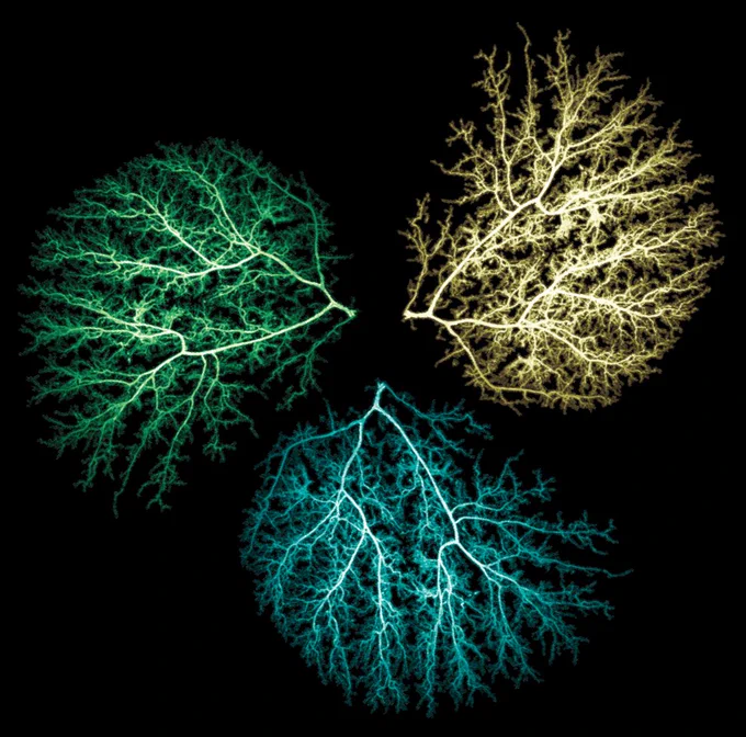 Hannah Hrncir
Mouse left liver lobe intrahepatic bile ducts labeled with EpCAM and imaged in 3D with light sheet microscopy. The hierarchical nature of intrahepatic bile ducts with large ducts at the liver hilum that get smaller as they move towards the periphery is clearly illustrated. 'The tree of life'. Proper IHBD structure is essential to life. 