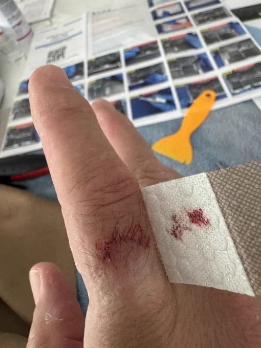 Deep cut from trying to slide off the back case of a Macbook Pro