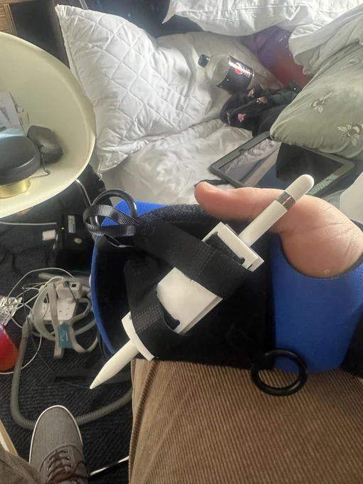 A black and blue hand grip on my wrist and hand. There is an Apple Pencil inserted in a white part with black Velcro straps holding it tight.