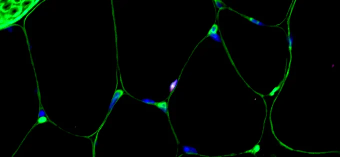 Transverse section through mouse hindlimb skeletal muscle, with an α-catenin-deficient MuSC actively cycling