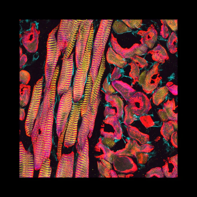 The entry “Speak Now” by Rhonda Powell. The image is overall vividly neon pink with yellow highlights and a black background. The picture is of a sheep tongue taken under a microscope. On one side are pink blobs, some looking a bit like scaly cheerios, with yellow and neon blue highlights, on the other side are some tapered grub-looking bright pink and yellow ribbed cylinders.