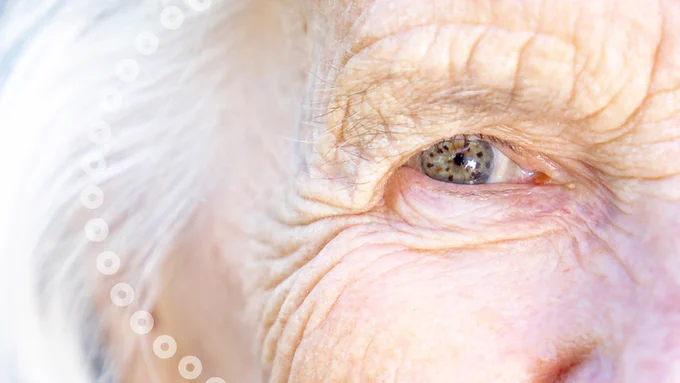 old persons eye