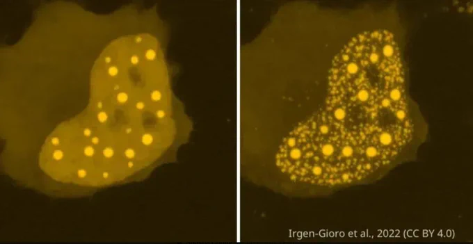 Liquid-liquid phase separation of some proteins in yellow in a live mammalian cell (left) can look very different upon paraformaldehyde fixation (right). Protein after fixation are separated and look granular, rather than a smooth yellow background