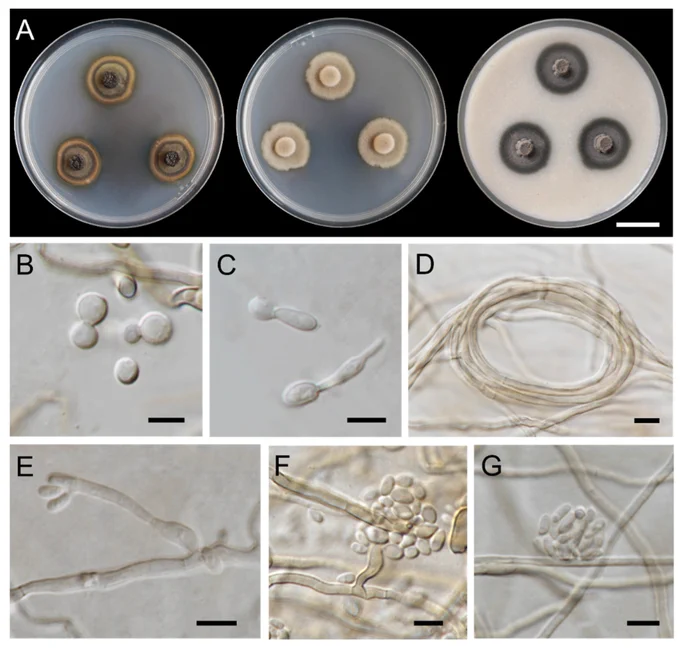Exophiala lamphunensis (SDBR-CMU404, holotype): (A) Colony at 25 °C for 28 days on PDA, MEA, and OA, respectively; (B) budding cells; (C) germinating cells; (D) hyphal coil; (E,F) subcylindrical conidiophore and conidiogenous cells; (E–G) conidia. Scale bars: (A) = 2 cm; (B–G) = 5 μm. 