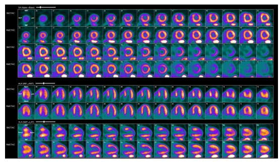 Perfusion images 

