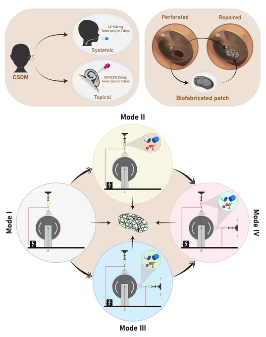 Scheme 1: Conventional antibiotic therapies for chronic suppurative otitis media (CSOM). The figure highlights the high concentration of ciprofloxacin (CIP) to which the patient is exposed during systemic (1000 mg per day) and topical (1 mg per day) treatments.

Scheme 2: Biofabricated patch with antibiotic releasing capabilities.

Scheme 3: Distinct electrospinning (ES) modalities investigated in this study. Mode I: basic ES with PEOT/PBT (control condition). Mode II: blend ES with PEOT/PBT/CIP. Mode III: co-ES/electrospraying with PEOT/PBT and PLGA/CIP NPs. Mode IV: combination of mode II and III. The arrows represent generation of subsequent modes by suitably adapting the previous one.