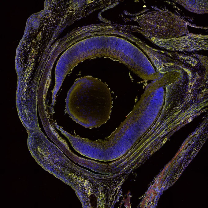 A titled microscope image of a cross section of a mouse eye. 