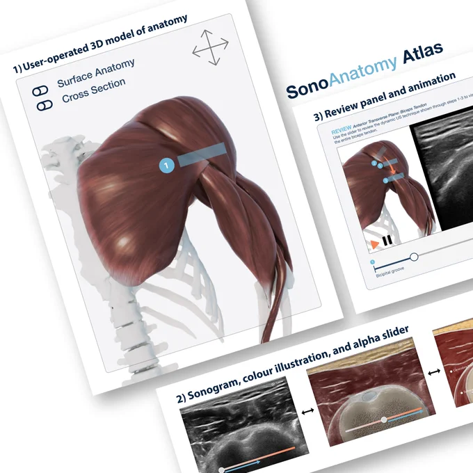 Compilation of images from Jayne Leggatt's "Sonoanatomy Atlas." The images include Jayne's illustration of the internal anatomy of the shoulder, a sample review panel and animation, a sonogram of the shoulder side-by-side with a colour illustration and alpha slider. Compilation courtesy of J. Leggatt.