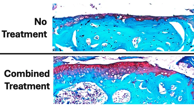 This figure shows the extent of cartilage damage after 6 weeks of daily loading and treatment compared to a non-loaded control knee with no cartilage damage present. The cartilage is stained red, and the bone is stained bluish green. Overall, combined parathyroid hormone pretreatment prior to loading and alendronate treatment during loading had the least cartilage damage (loss of red-stained tissue) and preserved the most cartilage.