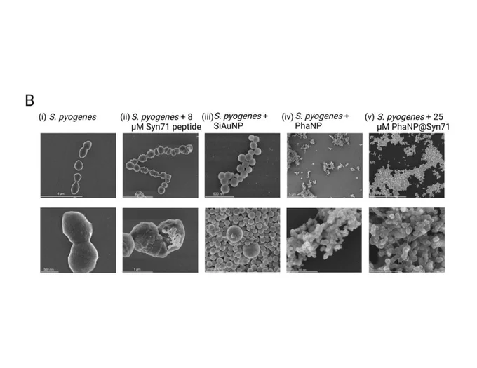 Images Armknecht created for the paper, “Antimicrobial peptide-conjugated phage-mimicking nanoparticles exhibit potent bactericidal action against Streptococcus pyogenes in murine wound infection models,