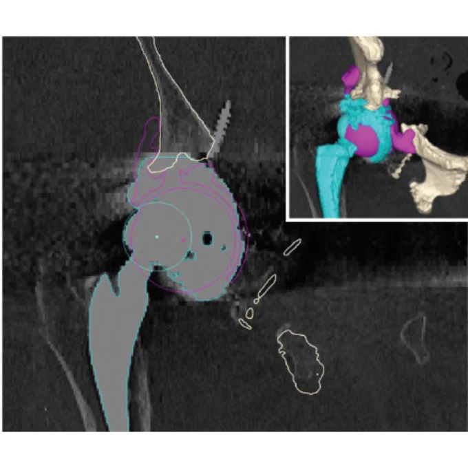 Image depicts the centre of the cavity of the acetabular component estimated in 3D imaging.