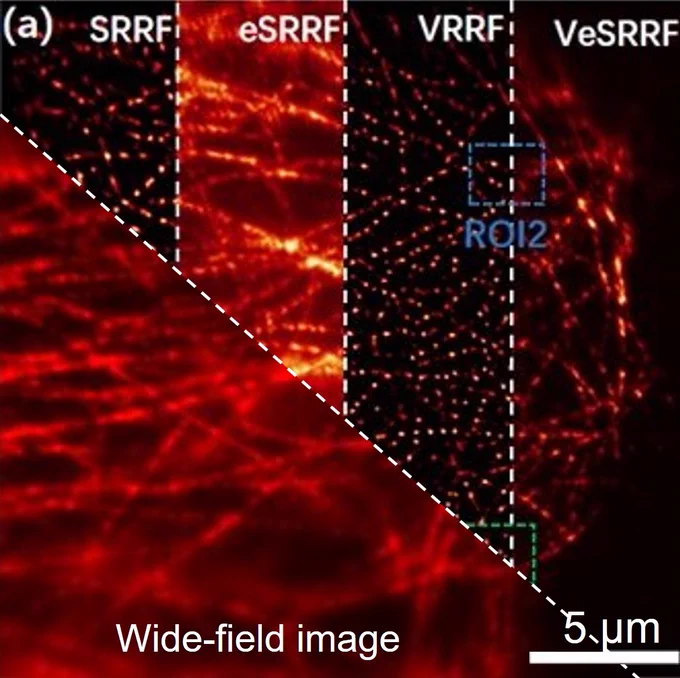 A comparison of the standard wide-field image, other super-resolution images (SRRF, eSRRF, and VRRF) and the super-resolution VeSRRF image of Tubulin-QD800 in a fixed Hela cell.