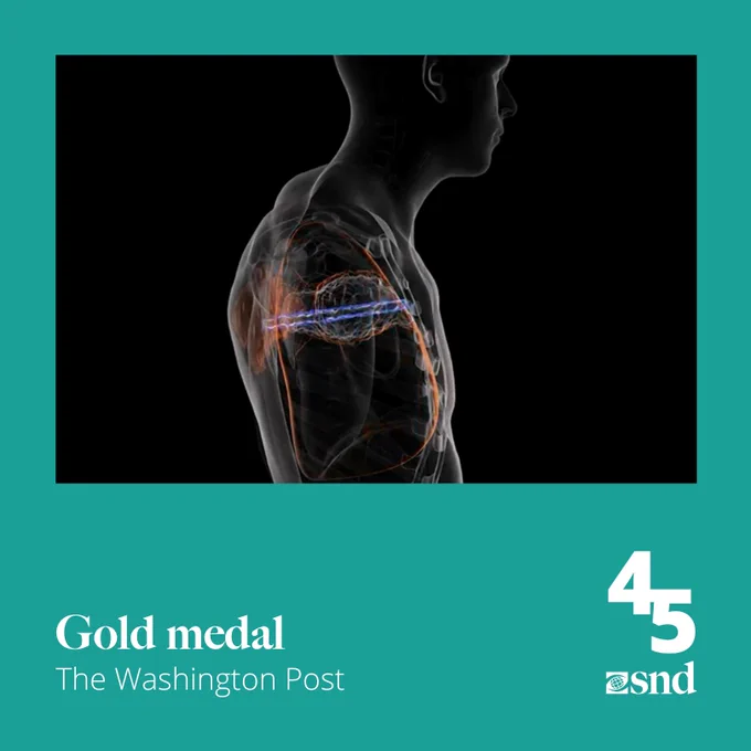 This image features a digital rendering of a human body from the side view, awarded a gold medal by The Washington Post. The visualization highlights the internal vascular and muscular systems using bright orange and blue lines against a dark background, creating a striking contrast. The detailed representation focuses on the upper body, including the shoulder and chest, with a special emphasis on the complexity and interconnectivity of the human anatomy.


