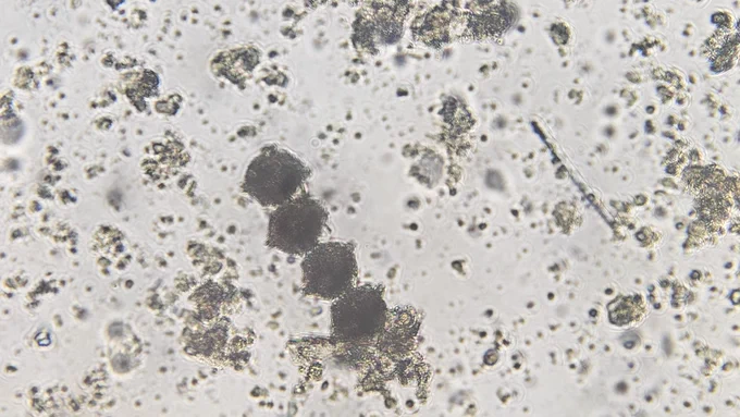Phytoplankton viewed under a microscope from a water sample collected in Laguna Grande