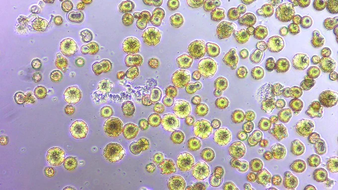 This image shows what pollen looks like with Acinetobacter, a genus of bacteria common in flowers. Many of the pollen grains are germinating and bursting. (Shawn Christensen, UC Davis)
