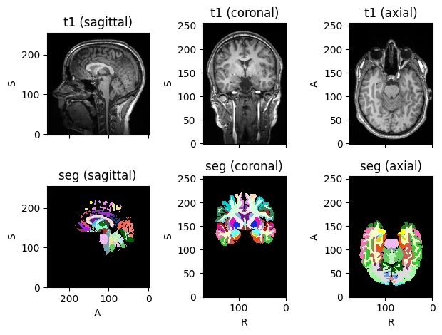 MRI image and segmentation before slicing.