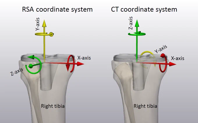 Figure 3. (A) The RSA migration coordinate system for a right-sided
tibia with X-axis pointing medially, Y-axis pointing superiorly, and
Z-axis pointing anteriorly. (B) The CT migration coordinate system for
right-sided tibia with X-axis pointing medially, Y-axis pointing posteriorly,
and Z-axis pointing superiorly.