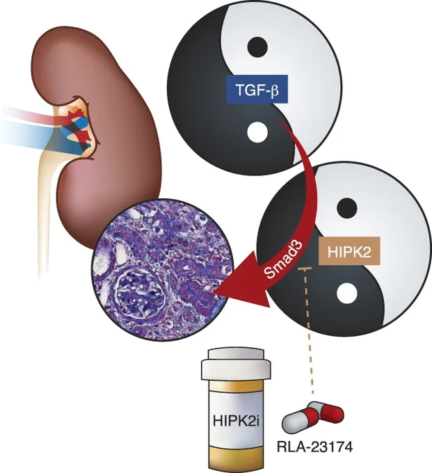 Efficacy of HIPK2 inhibitor against kidney fibrosis. While TGF-β or HIPK2 are key promoters of kidney fibrosis, because of their pleiotropic functions, full blockade of their functions may lead to adverse side effects. As HIPK2 is typically increased in disease settings to potentiate Smad3-mediated transcription, allosteric inhibition of HIPK2-Smad3 interaction by RLA-23174 is sufficient to markedly reduce kidney fibrosis, without incurring potential systemic toxicities associated with TGF-β or HIPK2 inhibition. HIPK2, homeodomain-interacting protein kinase 2; TGF, transforming growth factor.