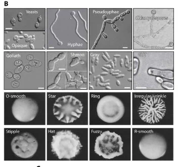 Different C. albicans morphologies