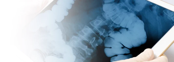 Image Source: https://www.qubiologics.com/category/news/