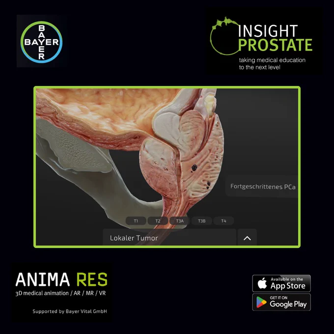 Insight Prostate Web Version für den Browser