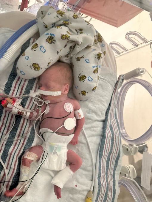 Elaina in her hospital bed while in the NICU as a baby