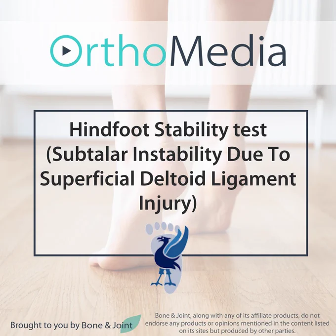 A faded image of a person on tiptoes. 

OrthoMedia logo. 

A textbox reads: Hindfoot Stability test (Subtalar Instability Due to Superficial Deltoid Ligament Injury) 

The Liverpool Foot and Ankle logo. 

Brought to you by Bone & Joint

Bone & Joint, along with any of its affiliate products, does not endorse any products or opinions mentioned in the content listed on its sites but produced by other parties.
