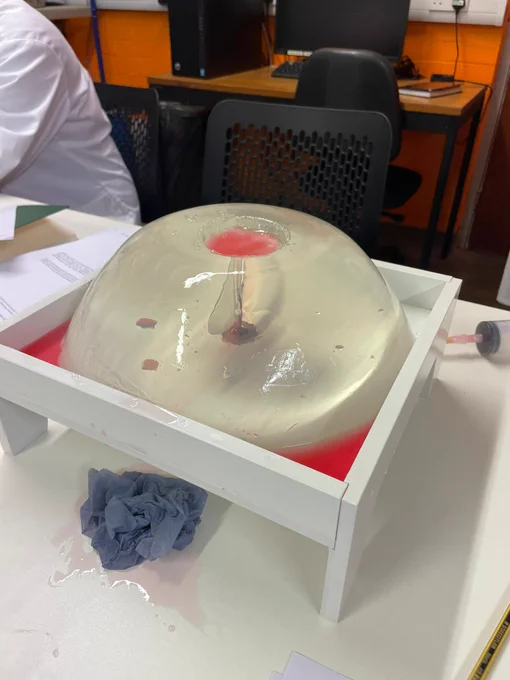 Erupted jelly volcano with an injection needle. 