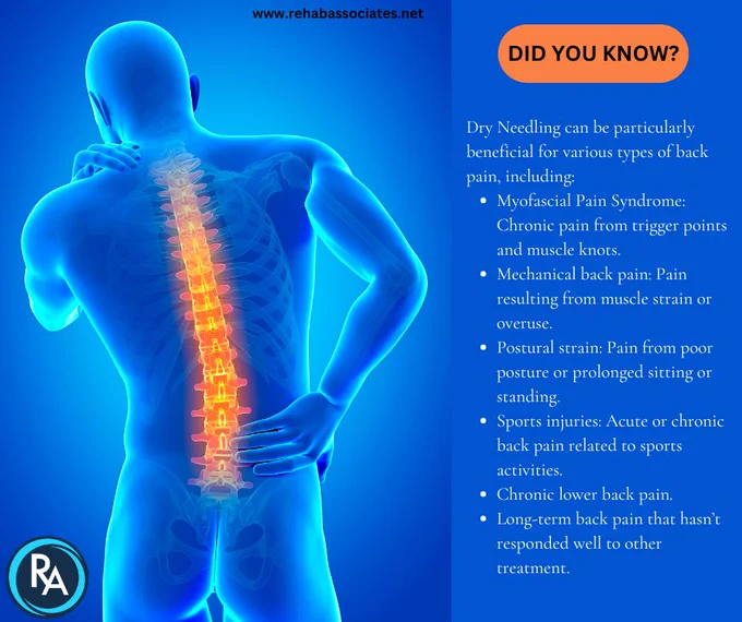  Dry needling involves the insertion of thin solid filament needles into trigger points within muscles, tendons, or near nerves. Give it a try. We have a lot of patients who benefit from this type of therapy. Schedule an appointment in Heath at 740-345-2837 or in Dresden at 740-565-4220.