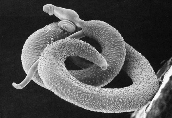 Abstract

Schistosomiasis is of medical and veterinary importance. Despite the critical situation of schistosomiasis in sub-Saharan Africa, few molecular epidemiological studies have been carried out to determine the role of animals in its transmission. In Mali, it has been over three decades since the last molecular study of animal schistosomes was carried out. It is now urgent to identify circulating strains of the parasite because of potential interactions with other schistosome species, which could complicate disease control. The aim of our work was to study the composition and genetic structure of schistosome populations collected from cattle. The prevalence of schistosome was 23.9%, with the prevalences of Schistosoma bovis (Sb) and S. curassoni (Sc) estimated at 12.6% and 9.8%, respectively. No hybrid strains or S. haematobium were found. 

ILLUSTRATION: Schistosoma mansoni, from Wikimedia. Public Domain.