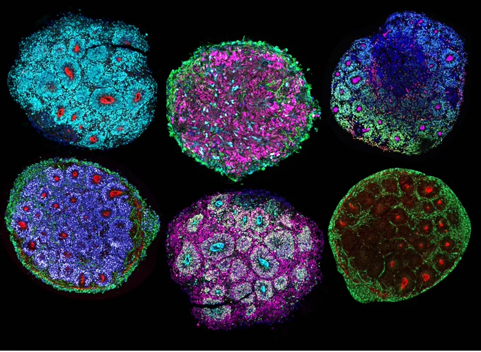 Slide depicting a composition of six multicolor brain chimeroids
