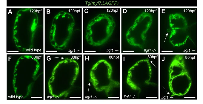 Figure 1 A-J: Llgl1 promotes organised trabeculation and ventricular wall integrity. (A-J) Live light-sheet z-slices through the ventricle of Tg(myl7:LifeAct-GFP) transgenic wild-type and llgl1 mutant embryos visualising the myocardium at 120 hpf (A-E) and 80 hpf (F-J). Scale bars: 50 μm. Wild-type embryos have regular trabeculae emerging predominantly from the outer curvature of the ventricular wall at 120 hpf (A), whereas llgl1 mutant embryos exhibit disorganised trabeculae, ranging from wild-type-like (B), through to irregular trabecular CMs and multilayering of CMs (C-E). Some llgl1 mutants at 120 hpf exhibit apically extruding CMs (arrow, E). At 80 hpf in llgl1 mutants, CMs extrude apically from multiple locations in the ventricular wall (arrows G-J).