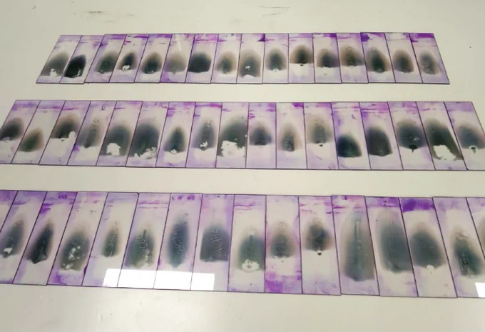 Blood biomarker tests
