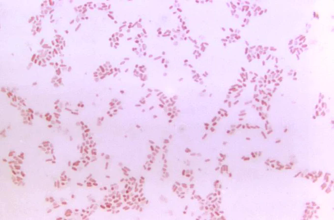 Bacteroides fragilis