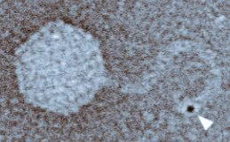 Immuno-gold labeling of the ubiquitin-like protein conjugated to the phage tail