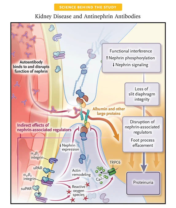 Science behind the Study
Kidney Disease and Antinephrin Antibodies

Diagram of the disruption of slit diaphragm by antinephrin autoantibodies
