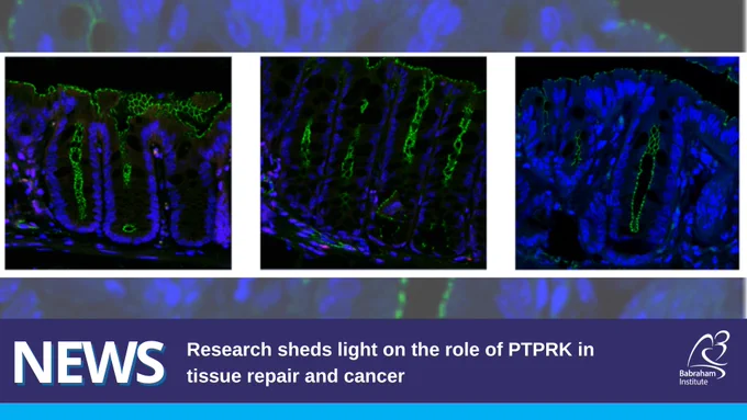 Image shows three immunofluorescent images of mouse colons stained for nuclei (DAPI;blue) and cellular junctions (ZO1; green). Text reads: News - Research sheds light on the role of PTPRK in tissue repair and cancer 