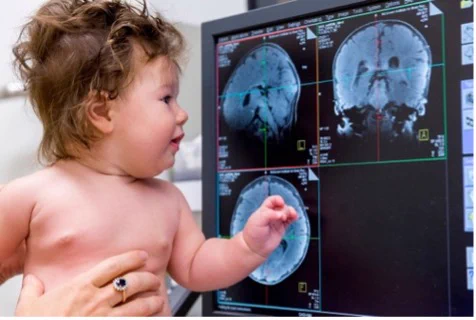 Picture of baby looking at MRI images of a brain on a computer monitor. 