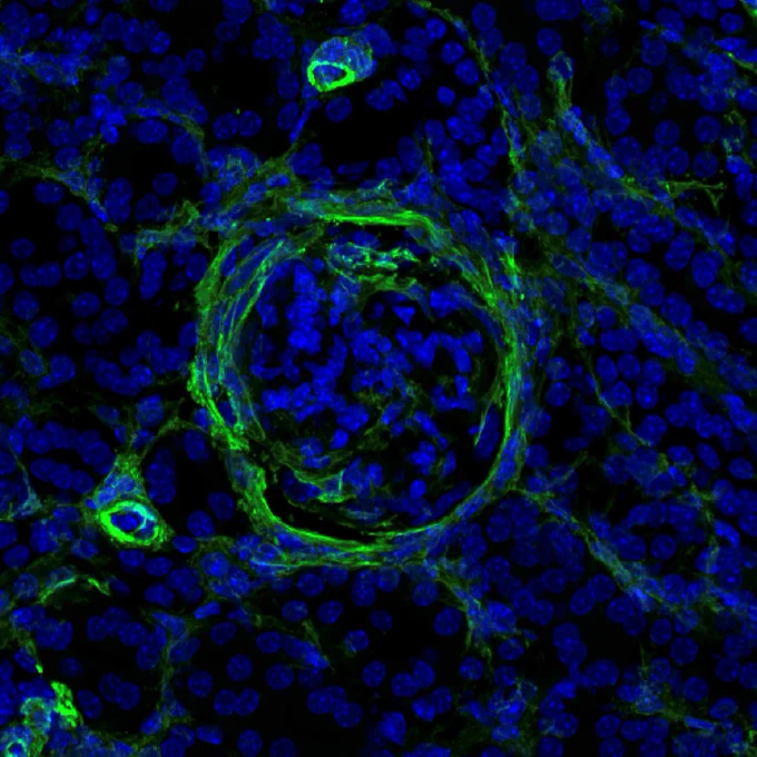 Kidney tissue (lupus mouse model) showing signs of incipient fibrosis (green). When the NKp46 receptor of the ILCs is blocked, the lupus nephritis recedes. Blue: cell nuclei. © Charité | Frauke Schreiber