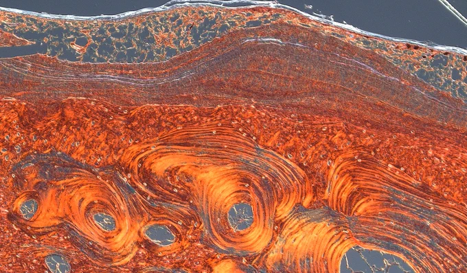 Biological armour: Rethinking the skeleton in the skin

By: Gabriella Burdette @uofg @LDI_ILD