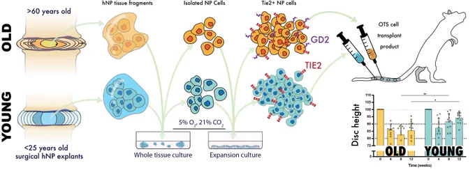 Abstract

Cell transplantation is being actively explored as a regenerative therapy for discogenic back pain. This study explored the regenerative potential of Tie2  nucleus pulposus progenitor cells (NPPCs) from intervertebral disc (IVD) tissues derived from young (<25 years of age) and old (>60 years of age) patient donors. We employed an optimized culture method to maintain Tie2 expression in NP cells from both donor categories. Our study revealed similar Tie2 positivity rates regardless of donor types following cell culture. Nevertheless, clear differences were also found, such as the emergence of significantly higher (3.6-fold) GD2 positivity and reduced (2.7-fold) proliferation potential for older donors compared to young sources. Our results suggest that, despite obtaining a high fraction of Tie2  NP cells, cells from older donors were already committed to a more mature phenotype. These disparities translated into functional differences, influencing colony formation, extracellul