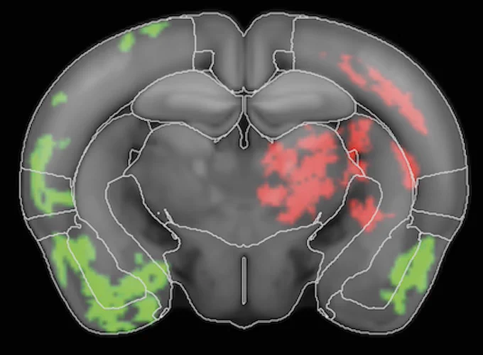 MRI of a mouse brain. Red patches indicate regions where neuromodulation decreased pathology, and green patches indicate regions where pathology increased after neuromodulation.